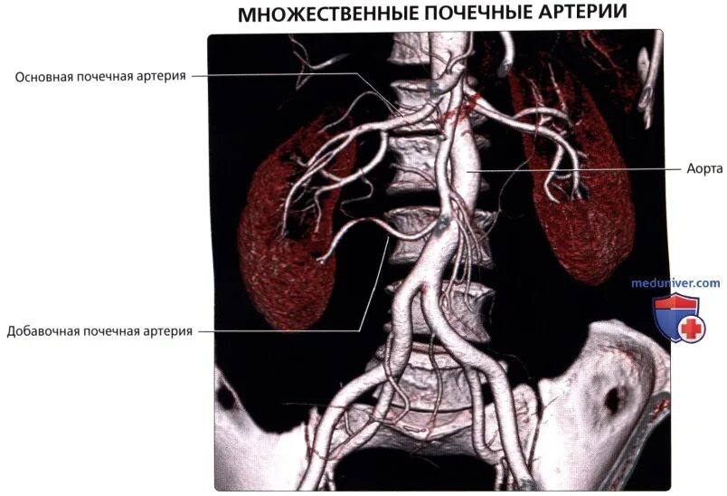 Почечные артерии анатомия. Нижняя полюсная почечная артерия. Анатомия почечных артерий на кт. Анатомия почки на кт. Функция почечной артерии