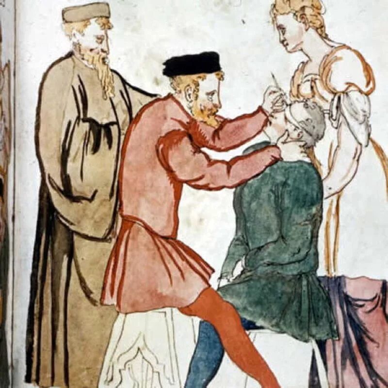 Хирургия эпохи возрождения. Реклинация катаракты в древности. Средневековая медицина медики средневековья.