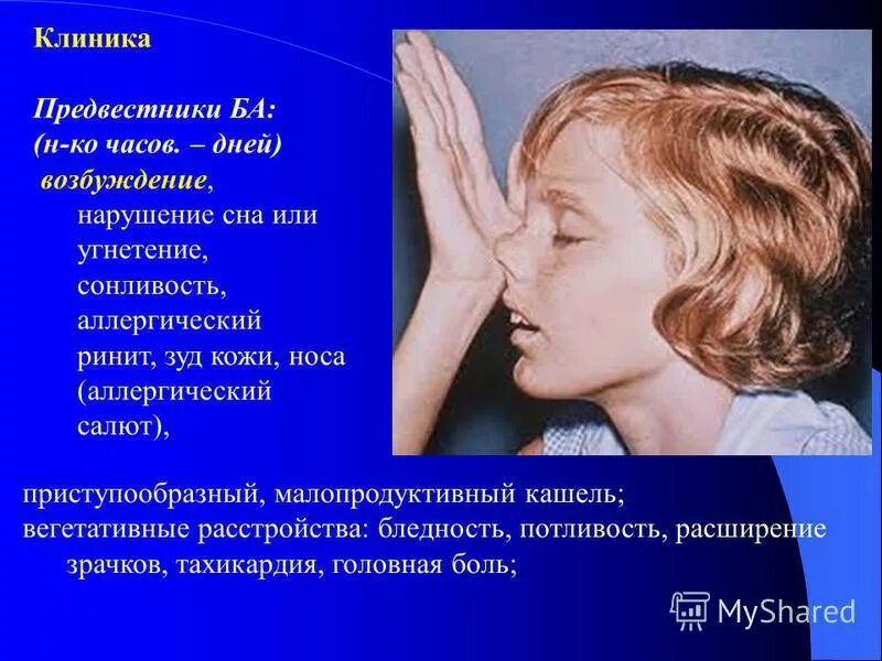 аллергический салют. симптом аллергического салюта. клинические проявления респираторных аллергозов. эпидермальные аллергены список. аллергический салют у детей.