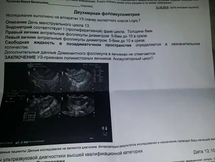 Ановуляторный цикл что это