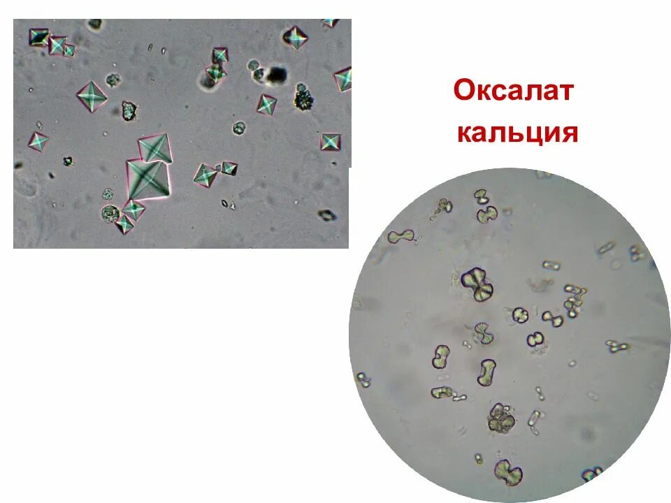 Микроскопия осадка мочи оксалаты. Оксалаты кальция в моче микроскопия. Лейкоциты в моче Нечипоренко микроскопия. Микроскопия мочи эпителий.