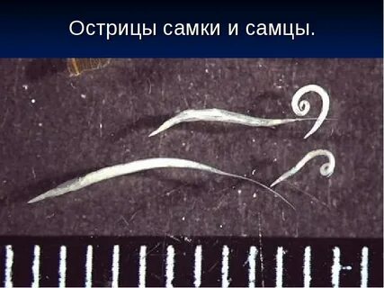 Острица фото лечение