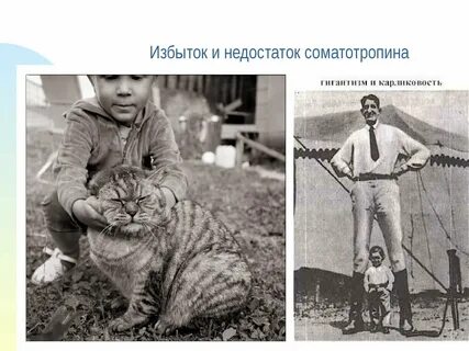 Карликовость гигантизм акромегалия