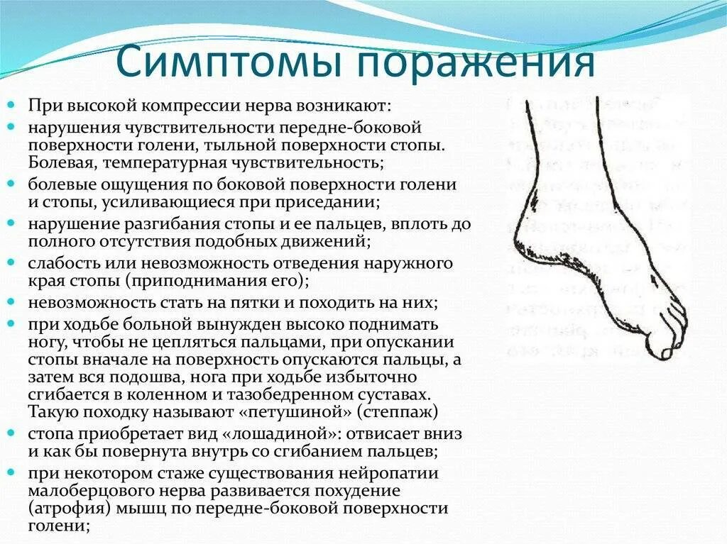 Невропатия суставов. Симптомы при повреждении малоберцового нерва. Симптомы повреждения общего малоберцового нерва. Воспаление малоберцового нерва симптомы. Туннельный синдром поверхностного малоберцового нерва.