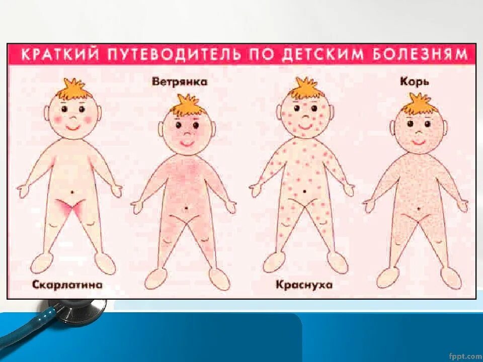 Как распознать корь у ребенка. Корь краснуха скарлатина сыпь сыпь. ветрянка скарлатина корь краснуха сыпь. высыпания корь краснуха.