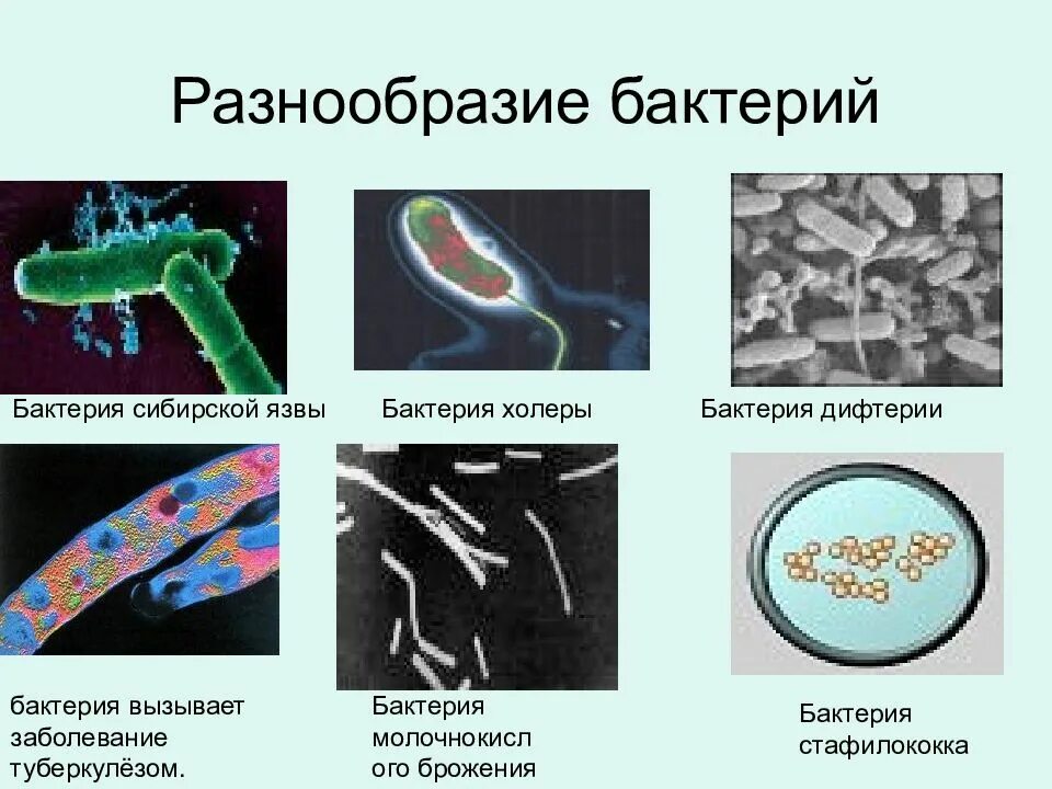 Болезнетворные бактерии биология. Биология 5 класс микроорганизмы бактерии. Бактерии вызывающие дифтерию. Болезнетворные бактерии дифтерия.