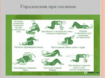 Шейный сколиоз упражнения