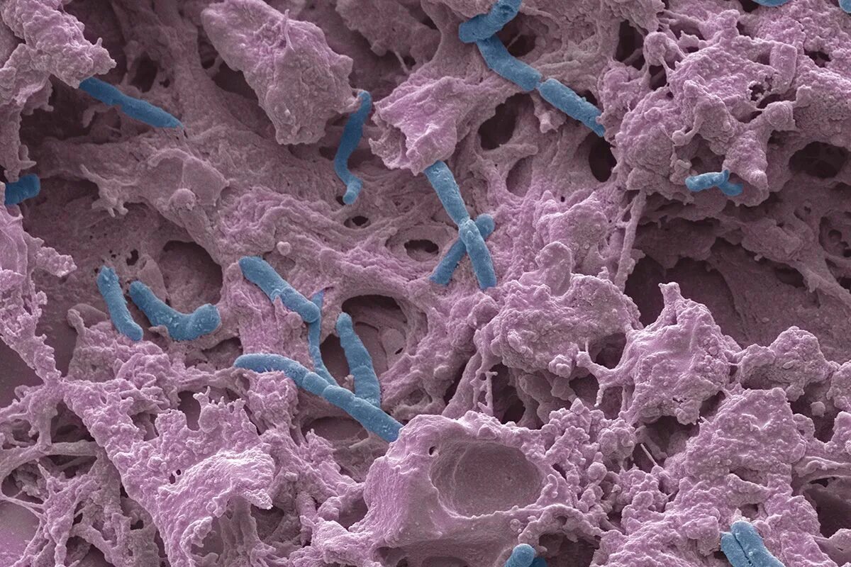 Медицинские бактерии. Псевдомонады патогенность. Pseudomonas aeruginosa микроскоп. Pseudomonas в микроскоп.