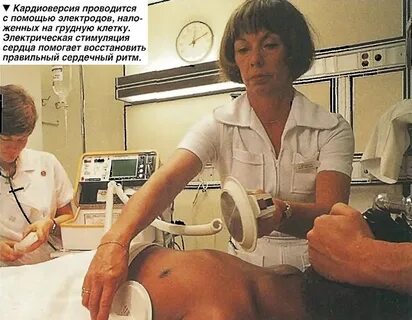 Кардиоверсия