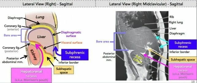 Right view