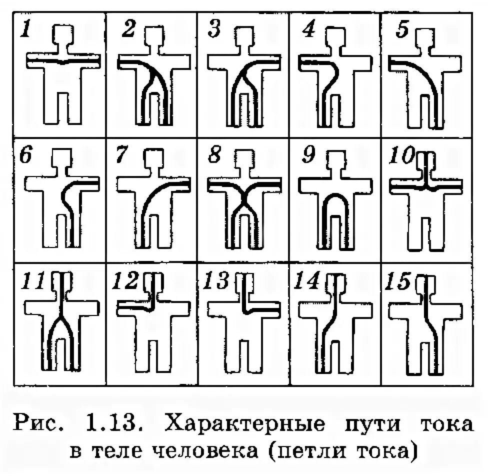 Какие петли тока наиболее опасны. Пути протекания тока (петли тока). Путь («петля») тока через тело человека. Наиболее опасный путь протекания тока через тело человека. Наиболее опасные пути протекания электрического тока.