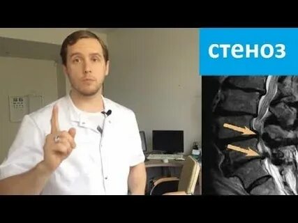 Епифанов грыжа