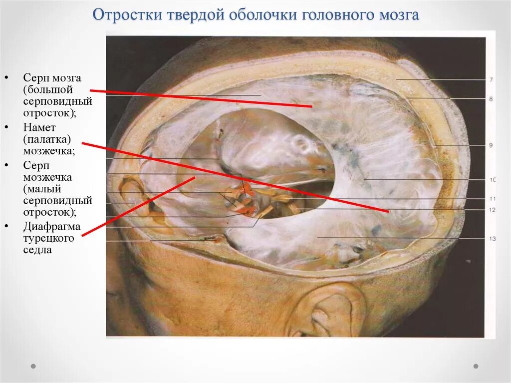 Диафрагма черепа. Твердая мозговая оболочка намет мозжечка. Твердая мозговая оболочка анатомия. Диафрагма седла твердой оболочки головного мозга. Серп большого мозга (твёрдая мозговая оболочка).