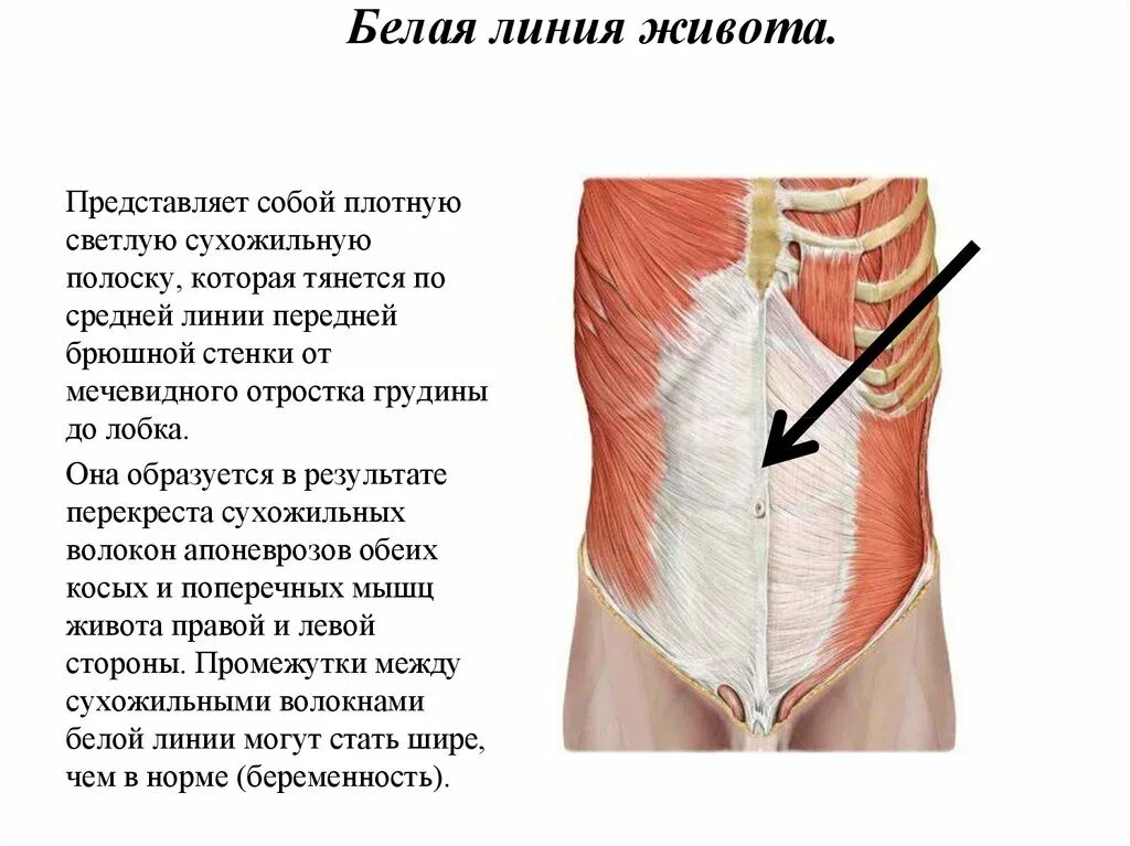 Белая линия живота образована апоневрозами мышц. Грыжа белой линии живота анатомические предпосылки. Грыжа передней брюшной стенки это белой линии. Грыжа белая линия живота анатомические структуры.