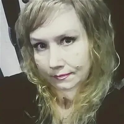 Откуда шрам у ольги малащенко