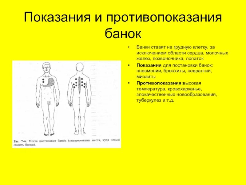 Можно ли при бронхите ванна