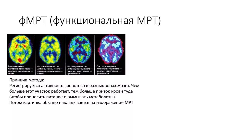 Магнитно-резонансная томография головного мозга физиология. ФМРТ И мрт различия. Функционально магнитно резонансная томография. Принцип метода ФМРТ.