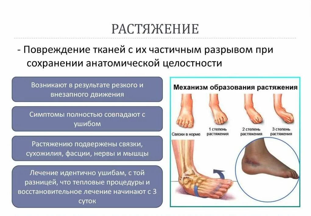 Болит голеностопный сустав что делать. Надрыв связок голеностопного сустава гематома. Растяжение голеностопной связки 1 степени. Процесс заживление растяжение связок голеностопа. Растяжение и разрыв связок.