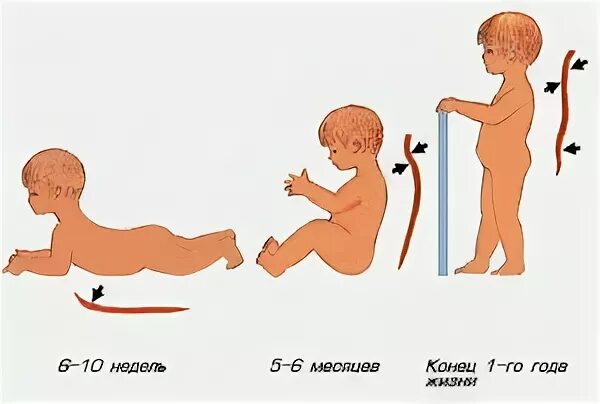Изгибы позвоночника у детей. Формирование изгибов позвоночника у ребенка. Формирование изгибов позвоночника у ребенка сроки. Грудной кифоз у грудного ребенка.