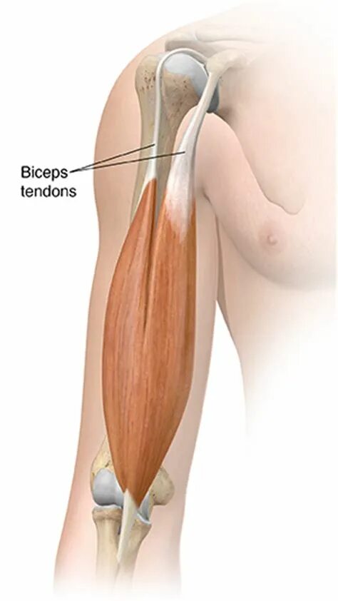 Тендинит длинной головки бицепса. Тенодез длинной головки бицепса.