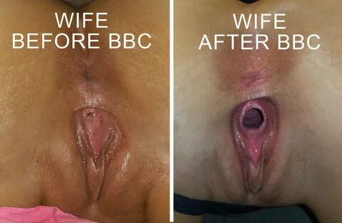 Raw Vagina After Sex.