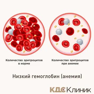 Эритроциты в норме гемоглобин понижен
