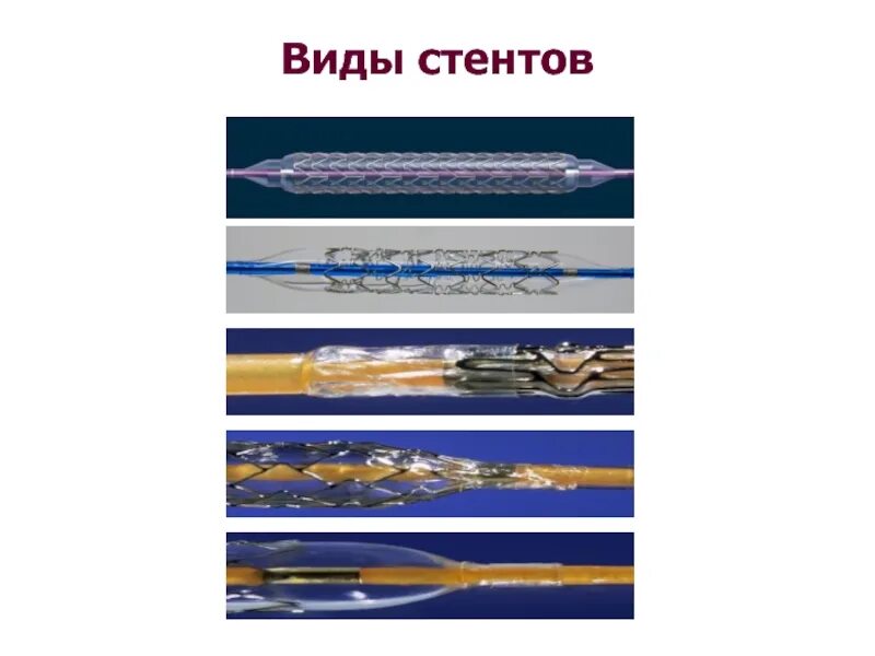 Лекарственный стент. Виды стентов. Виды коронарных стентов. Типы стентов для коронарных сосудов. Стенты для коронарных сосудов с лекарственным покрытием.