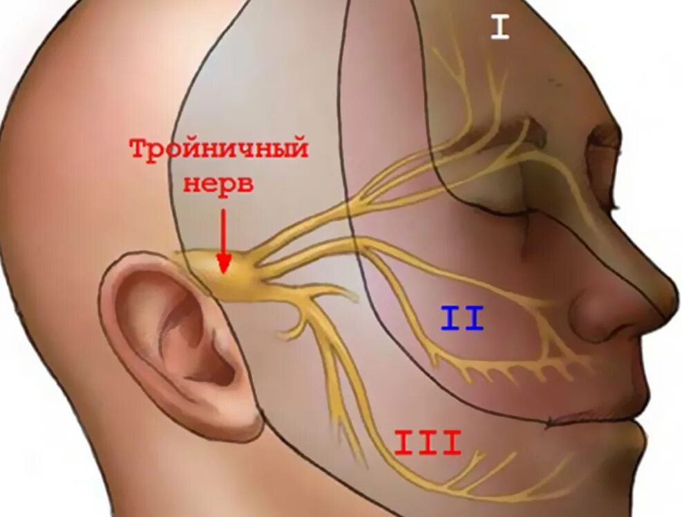 Почему дергает ухо. Неврит 2 ветви тройничного нерва. Невропатия II ветви тройничного нерва. Невралгия 1 2 тройничного нерва. Защемление невралгия тройничного нерва.