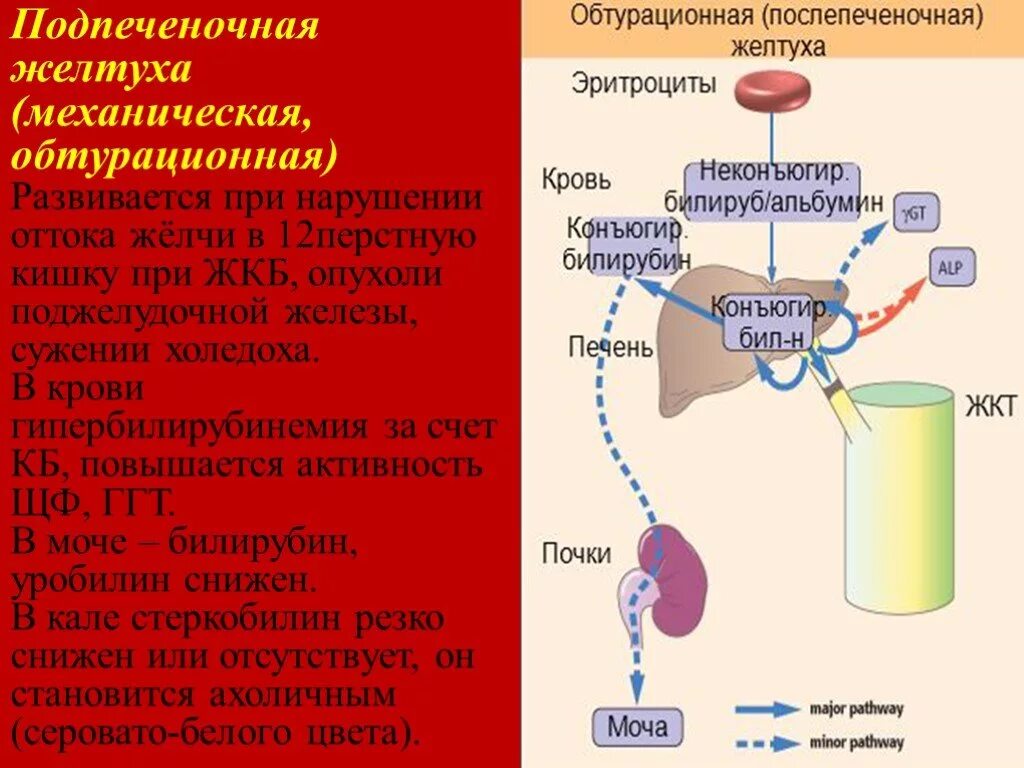 Гепатит ферменты. Механизм гемолитической желтухи биохимия. Биохимическое исследование крови при механической желтухе. Подпеченочная желтуха билирубин. Биохимия при обтурационной желтухе.