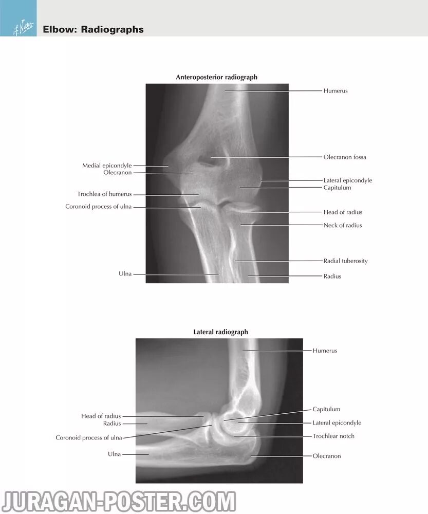 рентгеноанатомия локтевого сустава. анатомия связок локтевого сустава на рентгене. рентгеноанатомия локтевого сустава. локтевой сустав рентген описание. локтевой сустав рентген анатомия у детей.