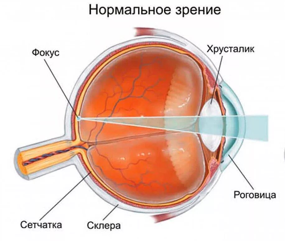 Оптическая точка зрения. Патология рефракции гиперметропия. Зрение при близорукости. Зрение при дальнозоркости.