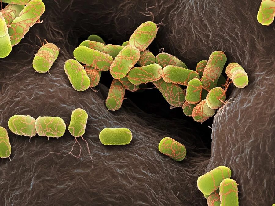 Кишечная палочка Escherichia coli. Бактерия Escherichia coli. Эшерихия кишечная палочка. Бактерия эшерихия коли. Кишечная палочка половым