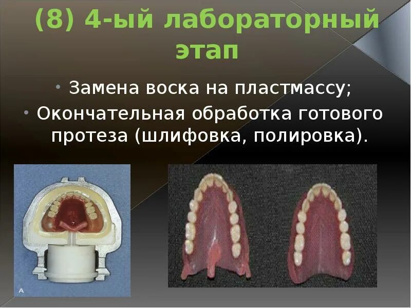 Границы пластиночного протеза. Полный съемный пластиночный протез. Фиксация и стабилизация полных съемных протезов. Этапы изготовления полного съемного протеза. Съемный пластиночный протез этапы.