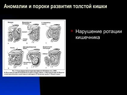 Развитие толстого кишечника
