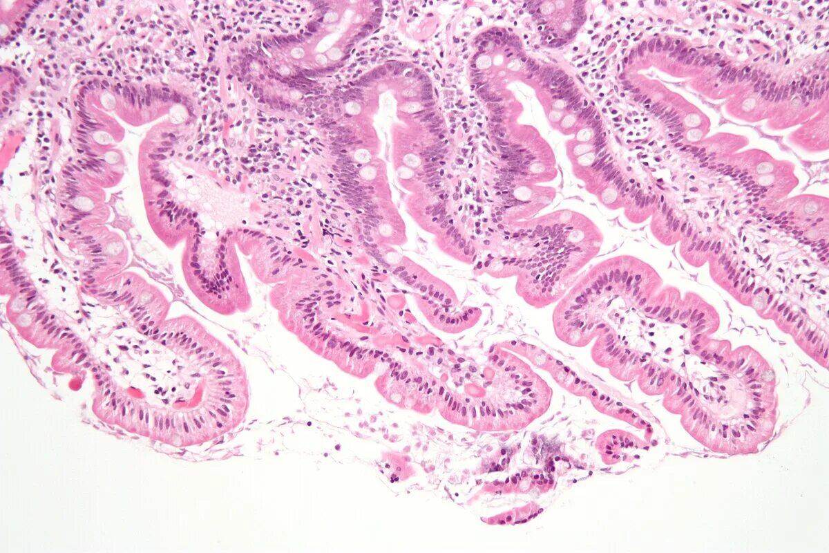 Биопсией слизистой оболочки. Микрофотографии гистология. Двенадцатиперстная кишка гистология.