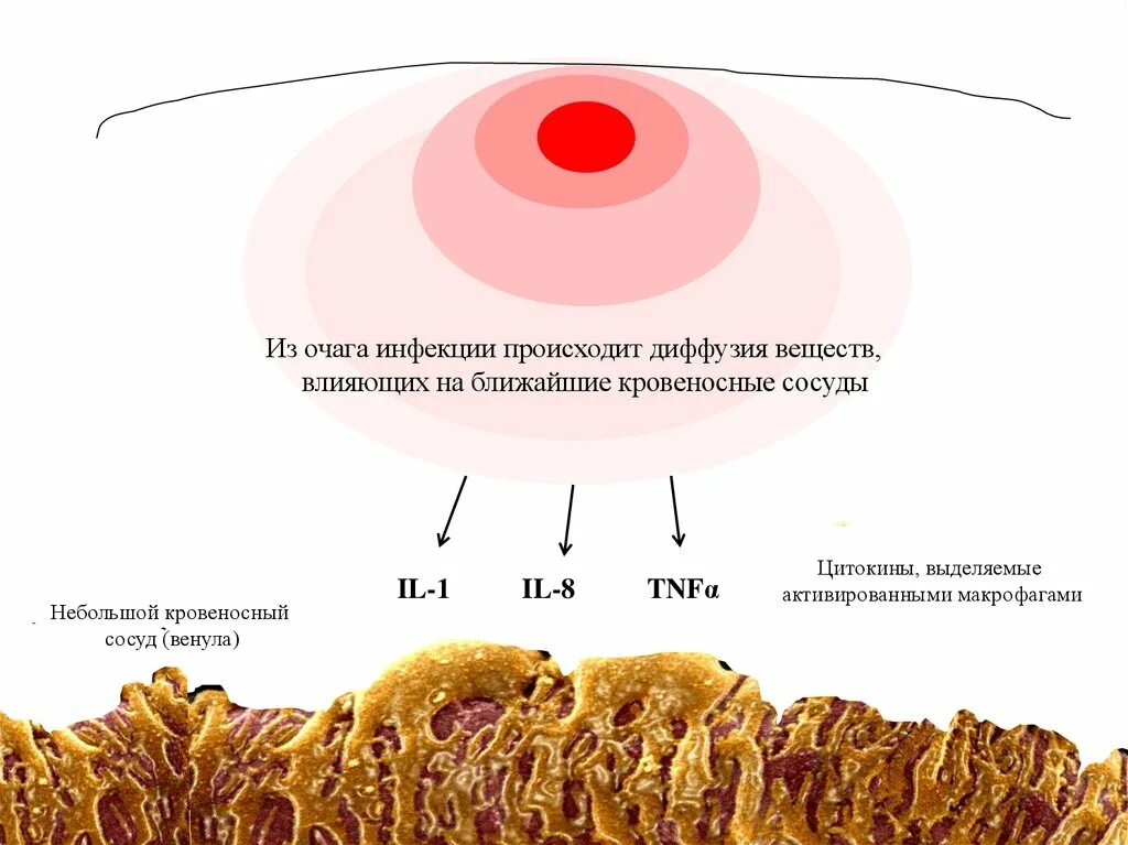 Очаг инфекционного поражения