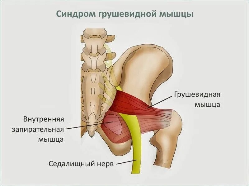 Мышца седалищного нерва. Грушевидная - Piriformis. Мускулюс пириформис. Грушевидная (m. Piriformis). Грушевидная мышца m. Piriformis.