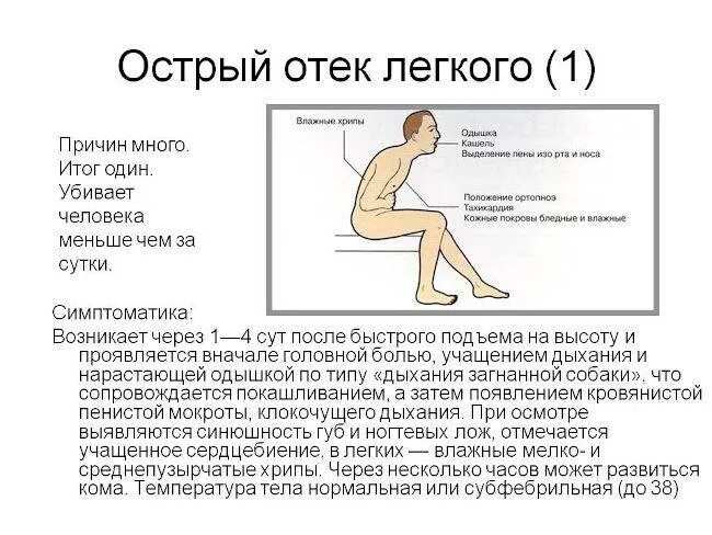 Отек легких симптомы у взрослых. Отек легких вынужденное положение. положение ортопноэ это при отеке легких. положение в постели при отеке легких\. причина возникновения отека легких.