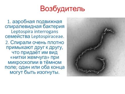 Лептоспироз возбудитель