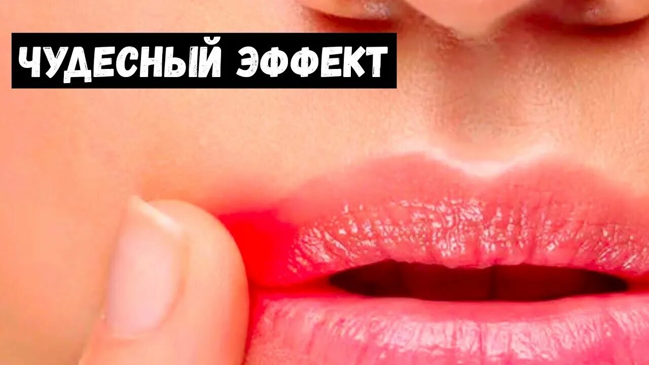 Красные губы как лечить. Красные губы как лечить