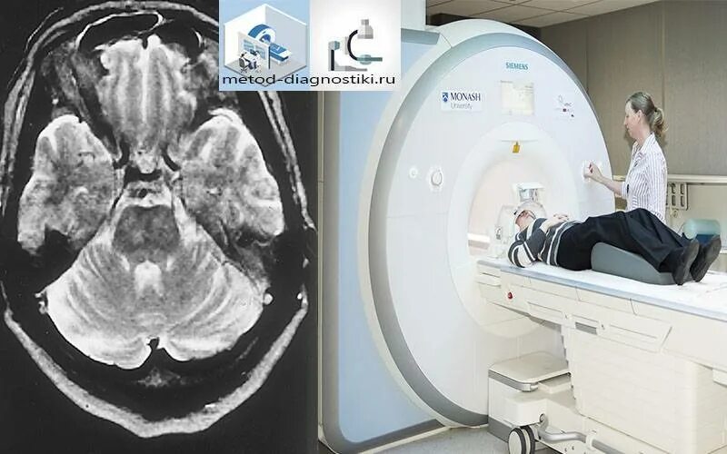 Магнито-резонансная томография головного мозга. Мрт головы с контрастом. Мрт головного мозга с контрастом. Магнитно резонансная томография с контрастом головного мозга. Телефоны платного кт