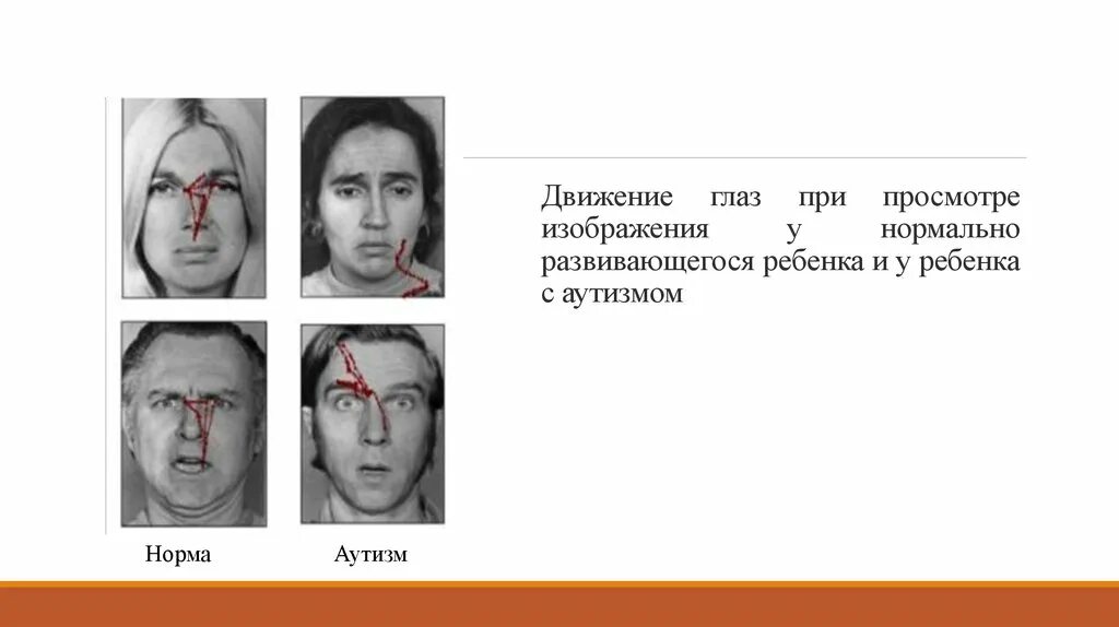 Движение глаз. Зрение у аутистов. Движение глаз при просмотре изображения. Движения при аутизме.