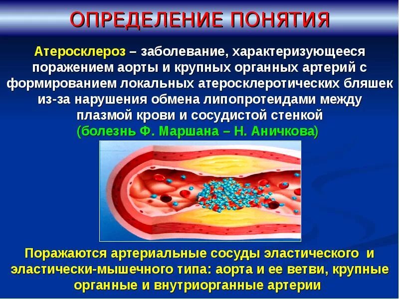 Атеросклероз что это за заболевание