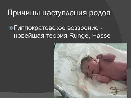 Роды не начинаются в срок