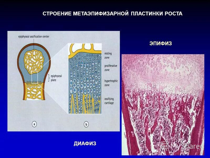 пластина роста. пластина роста. костная ткань ребенка. строение кости ростовая пластинка. пластина роста.