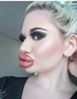 Большие Губы У Девушек Фото.