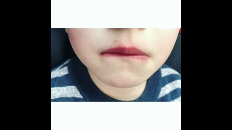 Облизывает губы. Почему ребенок облизывает губы. Мальчик облизывается. Дети которые облизывают губы. Дизартрия языка у детей.