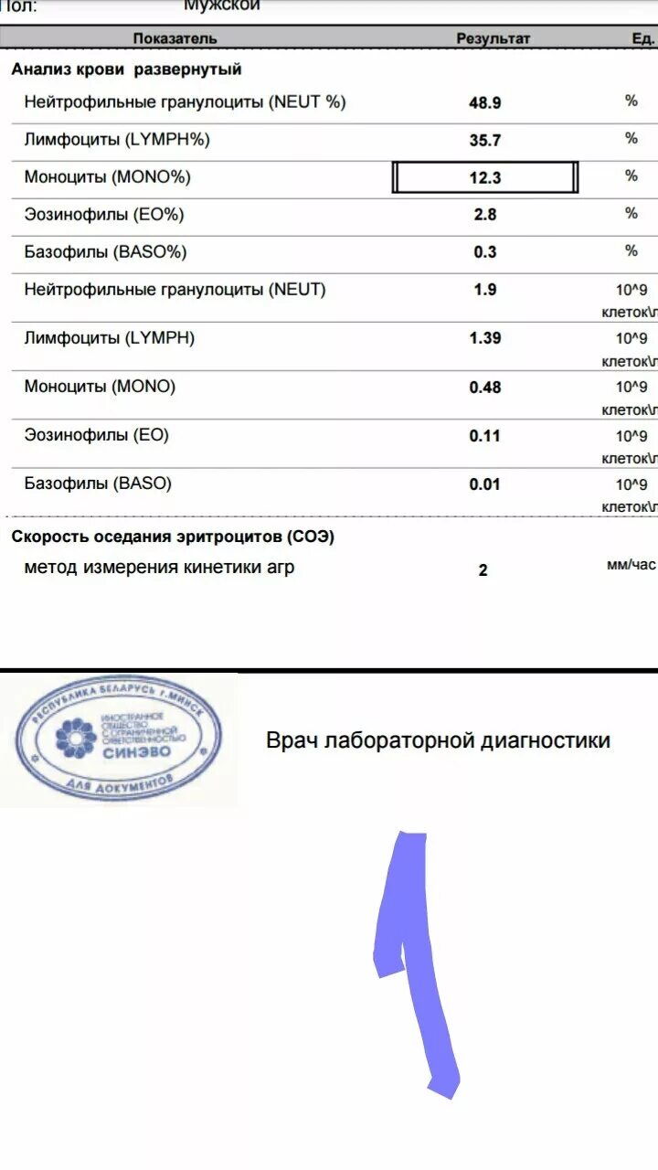 Пониженное содержание лимфоцитов. Пониженное содержание лимфоцитов