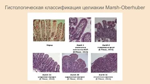 Классификация гистологии