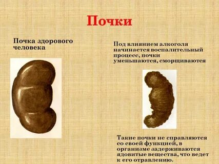 Почка стала больше